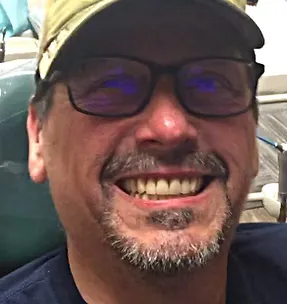 After traditional dentures: complete, natural-looking smile