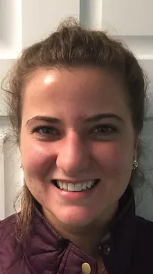 Before veneers: stained or uneven teeth